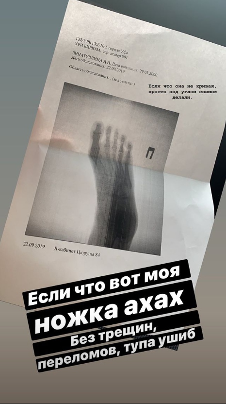 Рентгеновский снимок ступни, которая попала под колесо иномарки​Фото: Instagaram